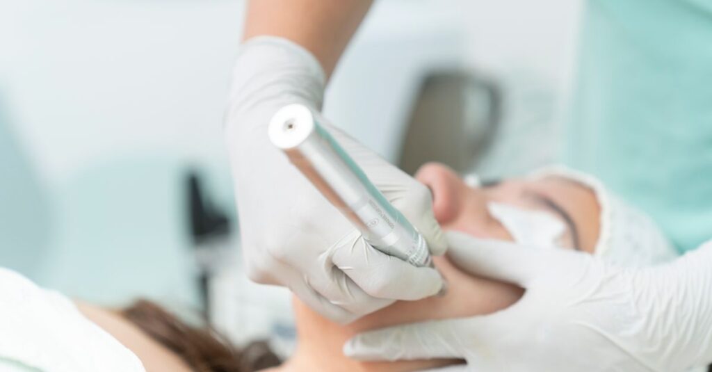 Close-up of a cosmetic treatment being performed in a clinical environment.